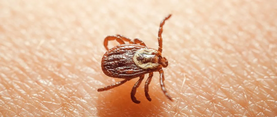 Skin with a tick in Croydon, PA.